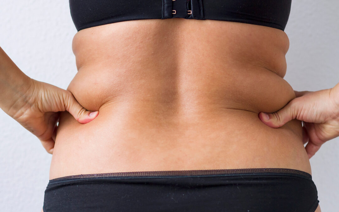 Improve Trouble Spots with Non-Surgical Body Contouring