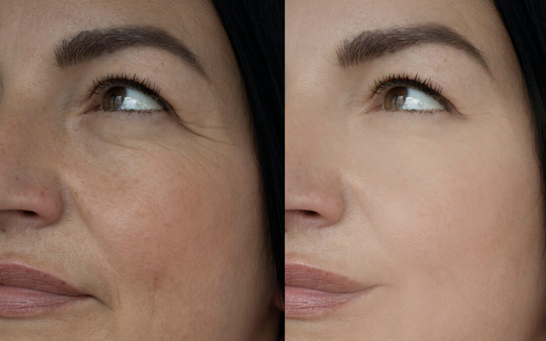 How To Improve Skin Tightness and Restore Youthful Glow