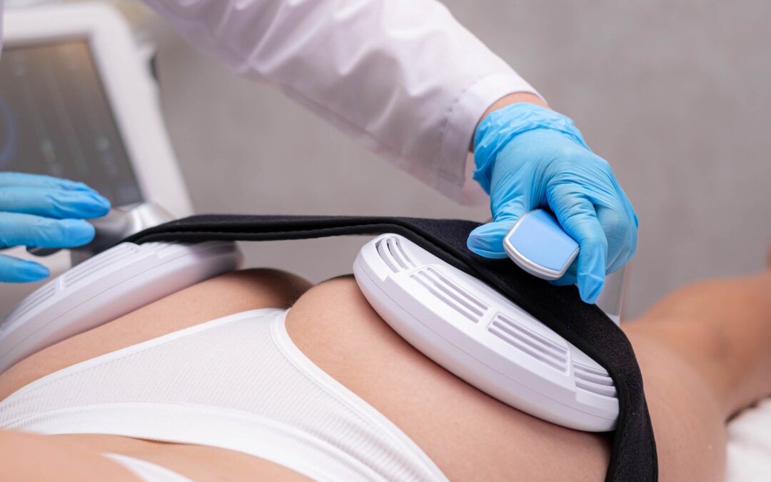 Non-Surgical Body Contouring Treatment Options