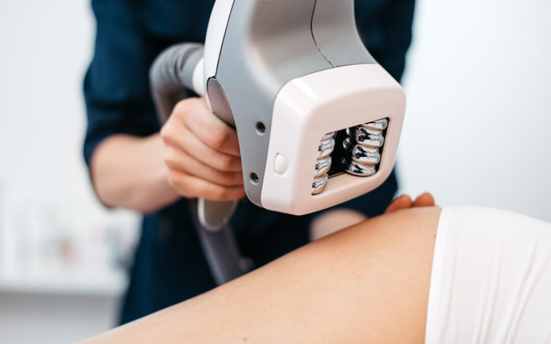 What Is a VelaShape Treatment?