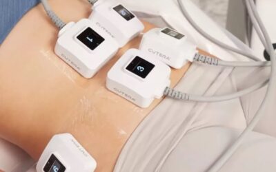 Transforming Your Body Without Surgery & Other truSculpt Benefits