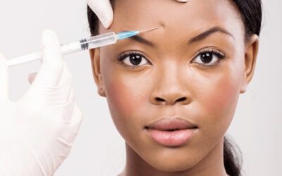 The Best Wrinkle Relaxing Treatments: Dysport 101